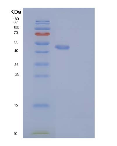 SDS-PAGE analysis of Human RAB27B (Ras-Related Protein Rab-27B) - Recombinant Protein, CATHuman RAB27B (Ras-Related Protein Rab-27B) - Recombinant Protein