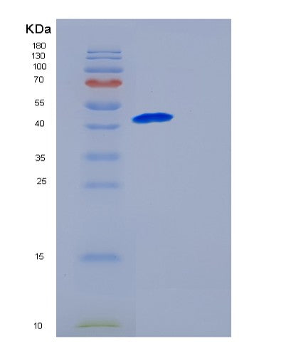SDS-PAGE analysis of Human GALK1 (Galactokinase) - Recombinant Protein, CATHuman GALK1 (Galactokinase) - Recombinant Protein