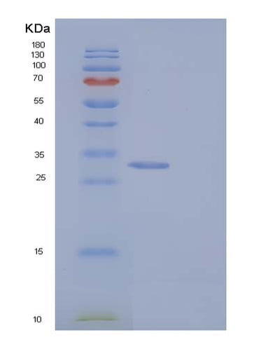SDS-PAGE analysis of Human BPHL (Valacyclovir Hydrolase) - Recombinant Protein, CAT# BLT-05051P, showing >90% purity under 15% SDS-PAGE (Reduced)Human BPHL (Valacyclovir Hydrolase) - Recombinant Protein