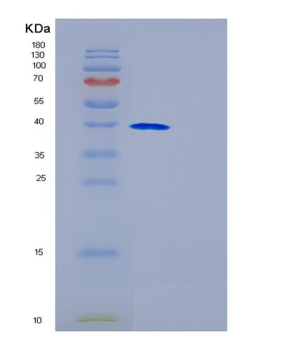 SDS-PAGE analysis of Human GALM (Galactose Mutarotase) - Recombinant Protein, CAT# BLT-01149P, showing >90% purity under 15% SDS-PAGE (Reduced)Human GALM (Galactose Mutarotase) - Recombinant Protein