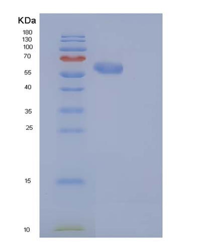 SDS-PAGE analysis of Human CAT (Catalase) - Recombinant Protein, CAT# BLT-05055P, showing >85% purity under 15% SDS-PAGE (Reduced)Human CAT (Catalase) - Recombinant Protein