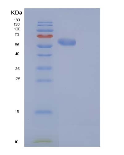 SDS-PAGE analysis of Human CAT (Catalase) - Recombinant Protein, CATHuman CAT (Catalase) - Recombinant Protein