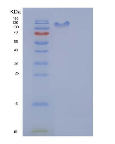 SDS-PAGE analysis of Human UBA1 (Ubiquitin-Like Modifier-Activating Enzyme 1) - Recombinant Protein, CAT# BLT-05061P, showing >85% purity under 15% SDS-PAGE (Reduced)Human UBA1 (Ubiquitin-Like Modifier-Activating Enzyme 1) - Recombinant Protein