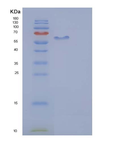 SDS-PAGE analysis of Human AFM (Afamin) - Recombinant Protein, CAT# BLT-05064P, showing >85% purity under 15% SDS-PAGE (Reduced)Human AFM (Afamin) - Recombinant Protein