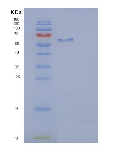 SDS-PAGE analysis of Human AFM (Afamin) - Recombinant Protein, CATHuman AFM (Afamin) - Recombinant Protein