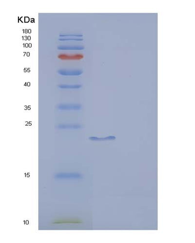 SDS-PAGE analysis of Human FCGR2A (Low Affinity Immunoglobulin Gamma Fc Region Receptor Ii-A) - Recombinant Protein, CAT# BLT-05065P, showing >85% purity under 15% SDS-PAGE (Reduced)Human FCGR2A (Low Affinity Immunoglobulin Gamma Fc Region Receptor Ii-A) - Recombinant Protein