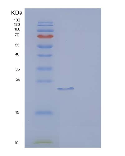 SDS-PAGE analysis of Human FCGR2A (Low Affinity Immunoglobulin Gamma Fc Region Receptor Ii-A) - Recombinant Protein, CATHuman FCGR2A (Low Affinity Immunoglobulin Gamma Fc Region Receptor Ii-A) - Recombinant Protein