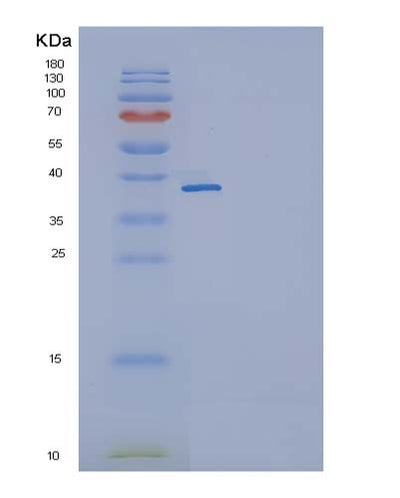SDS-PAGE analysis of Mouse Il11 (Interleukin-11) - Recombinant Protein, CAT# BLT-05066P, showing >85% purity under 15% SDS-PAGE (Reduced)Mouse Il11 (Interleukin-11) - Recombinant Protein