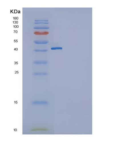 SDS-PAGE analysis of Human TNFRSF18 (Tumor Necrosis Factor Receptor Superfamily Member 18) - Recombinant Protein, CAT# BLT-05067P, showing >95% purity under 15% SDS-PAGE (Reduced)Human TNFRSF18 (Tumor Necrosis Factor Receptor Superfamily Member 18) - Recombinant Protein
