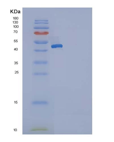 SDS-PAGE analysis of Human SERPING1 (Plasma Protease C1 Inhibitor) - Recombinant Protein, CAT# BLT-05068P, showing >85% purity under 15% SDS-PAGE (Reduced)Human SERPING1 (Plasma Protease C1 Inhibitor) - Recombinant Protein
