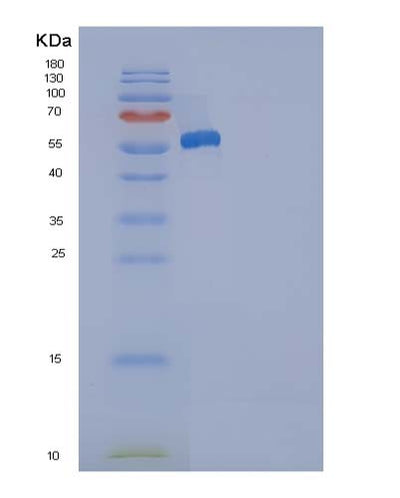 SDS-PAGE analysis of Human ANP32A (Acidic Leucine-Rich Nuclear Phosphoprotein 32 Family Member A) - Recombinant Protein, CAT# BLT-05069P, showing >90% purity under 15% SDS-PAGE (Reduced)Human ANP32A (Acidic Leucine-Rich Nuclear Phosphoprotein 32 Family Member A) - Recombinant Protein