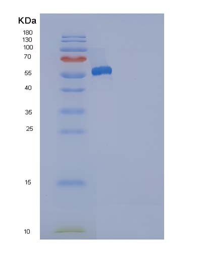 SDS-PAGE analysis of Human ANP32A (Acidic Leucine-Rich Nuclear Phosphoprotein 32 Family Member A) - Recombinant Protein, CATHuman ANP32A (Acidic Leucine-Rich Nuclear Phosphoprotein 32 Family Member A) - Recombinant Protein