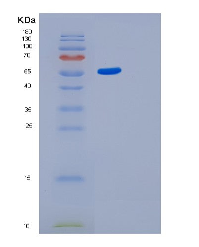 SDS-PAGE analysis of Human GBA3 (Cytosolic Beta-Glucosidase) - Recombinant Protein, CATHuman GBA3 (Cytosolic Beta-Glucosidase) - Recombinant Protein