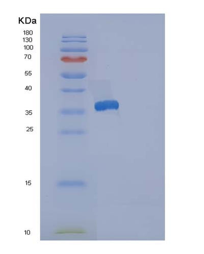 SDS-PAGE analysis of Human RCN3 (Reticulocalbin-3) - Recombinant Protein, CAT# BLT-05071P, showing >95% purity under 15% SDS-PAGE (Reduced)Human RCN3 (Reticulocalbin-3) - Recombinant Protein