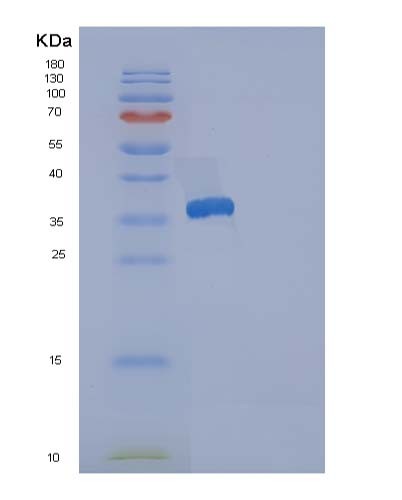 SDS-PAGE analysis of Human RCN3 (Reticulocalbin-3) - Recombinant Protein, CATHuman RCN3 (Reticulocalbin-3) - Recombinant Protein