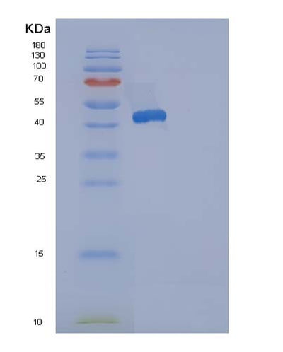 SDS-PAGE analysis of Human ACP1 (Low Molecular Weight Phosphotyrosine Protein Phosphatase) - Recombinant Protein, CAT# BLT-05072P, showing >90% purity under 15% SDS-PAGE (Reduced)Human ACP1 (Low Molecular Weight Phosphotyrosine Protein Phosphatase) - Recombinant Protein