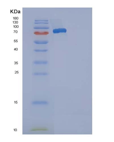 SDS-PAGE analysis of Mouse Selenop (Selenoprotein P) - Recombinant Protein, CAT# BLT-05073P, showing >85% purity under 15% SDS-PAGE (Reduced)Mouse Selenop (Selenoprotein P) - Recombinant Protein
