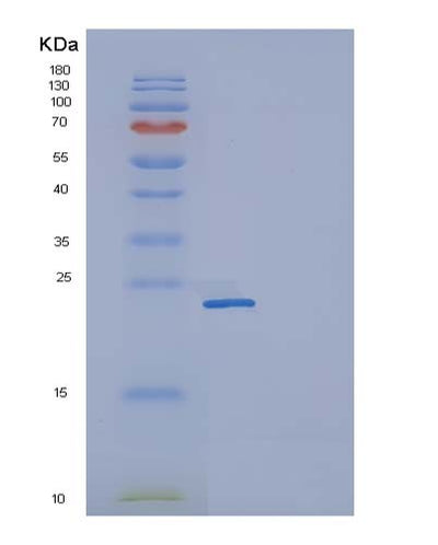 SDS-PAGE analysis of Human FCGR2A (Low Affinity Immunoglobulin Gamma Fc Region Receptor Ii-A) - Recombinant Protein, CAT# BLT-05076P, showing >95% purity under 15% SDS-PAGE (Reduced)Human FCGR2A (Low Affinity Immunoglobulin Gamma Fc Region Receptor Ii-A) - Recombinant Protein