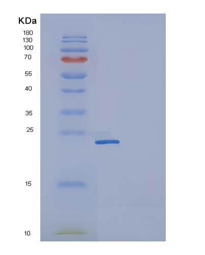 SDS-PAGE analysis of Human FCGR2A (Low Affinity Immunoglobulin Gamma Fc Region Receptor Ii-A) - Recombinant Protein, CATHuman FCGR2A (Low Affinity Immunoglobulin Gamma Fc Region Receptor Ii-A) - Recombinant Protein