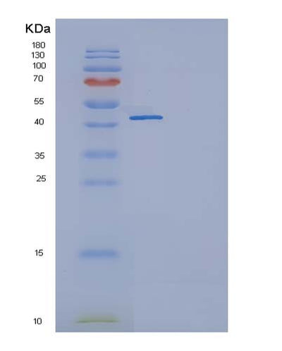 SDS-PAGE analysis of Human TNFRSF19 (Tumor Necrosis Factor Receptor Superfamily Member 19) - Recombinant Protein, CAT# BLT-05077P, showing >95% purity under 15% SDS-PAGE (Reduced)Human TNFRSF19 (Tumor Necrosis Factor Receptor Superfamily Member 19) - Recombinant Protein