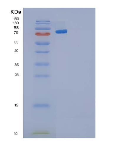 SDS-PAGE analysis of Human CDH3 (Cadherin-3) - Recombinant Protein, CAT# BLT-05081P, showing >90% purity under 15% SDS-PAGE (Reduced)Human CDH3 (Cadherin-3) - Recombinant Protein