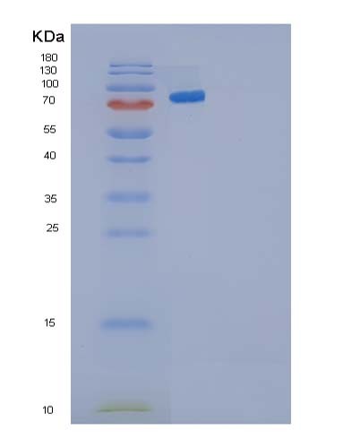 SDS-PAGE analysis of Human CDH3 (Cadherin-3) - Recombinant Protein, CATHuman CDH3 (Cadherin-3) - Recombinant Protein