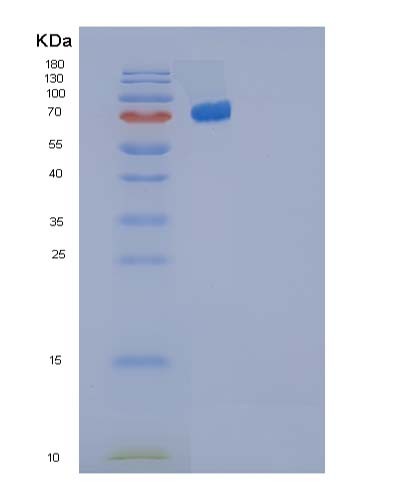 SDS-PAGE analysis of Human IL12A (Interleukin-12 Subunit Alpha) - Recombinant Protein, CATHuman IL12A (Interleukin-12 Subunit Alpha) - Recombinant Protein