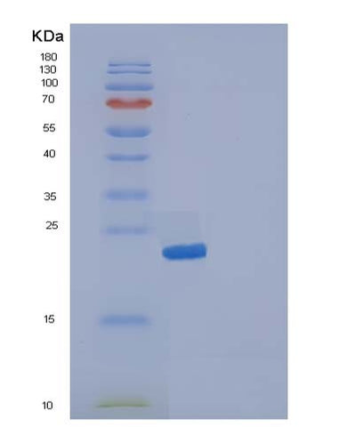 SDS-PAGE analysis of Human IL19 (Interleukin-19) - Recombinant Protein, CAT# BLT-05085P, showing >85% purity under 15% SDS-PAGE (Reduced)Human IL19 (Interleukin-19) - Recombinant Protein