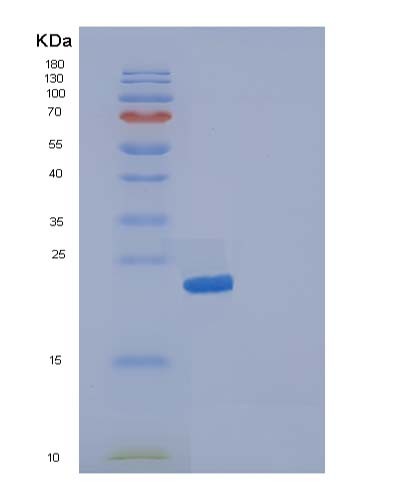 SDS-PAGE analysis of Human IL19 (Interleukin-19) - Recombinant Protein, CATHuman IL19 (Interleukin-19) - Recombinant Protein