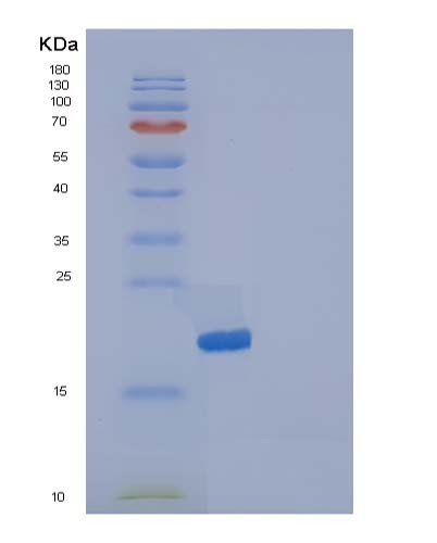 SDS-PAGE analysis of Human IL36RN (Interleukin-36 Receptor Antagonist Protein) - Recombinant Protein, CATHuman IL36RN (Interleukin-36 Receptor Antagonist Protein) - Recombinant Protein