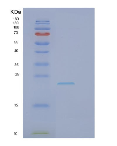 SDS-PAGE analysis of Human GCSAM (Germinal Center-Associated Signaling And Motility Protein) - Recombinant Protein, CAT# BLT-01167P, showing >90% purity under 15% SDS-PAGE (Reduced)Human GCSAM (Germinal Center-Associated Signaling And Motility Protein) - Recombinant Protein
