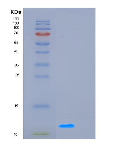 SDS-PAGE analysis of Human GCHFR (Gtp Cyclohydrolase 1 Feedback Regulatory Protein) - Recombinant Protein, CAT# BLT-01169P, showing >95% purity under 15% SDS-PAGE (Reduced)Human GCHFR (Gtp Cyclohydrolase 1 Feedback Regulatory Protein) - Recombinant Protein