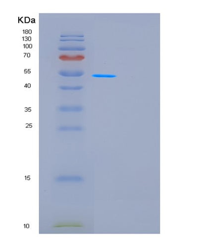 SDS-PAGE analysis of Human GDA (Guanine Deaminase) - Recombinant Protein, CAT# BLT-01175P, showing >95% purity under 15% SDS-PAGE (Reduced)Human GDA (Guanine Deaminase) - Recombinant Protein