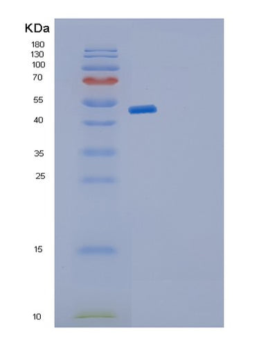 SDS-PAGE analysis of Human GDI2 (Rab Gdp Dissociation Inhibitor Beta) - Recombinant Protein, CAT# BLT-01183P, showing >85% purity under 15% SDS-PAGE (Reduced)Human GDI2 (Rab Gdp Dissociation Inhibitor Beta) - Recombinant Protein
