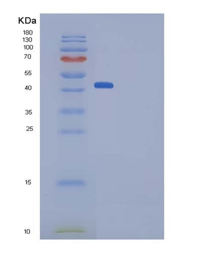 SDS-PAGE analysis of Mouse Ptn (Pleiotrophin) - Recombinant Protein, CAT# BLT-05089P, showing >90% purity under 15% SDS-PAGE (Reduced)Mouse Ptn (Pleiotrophin) - Recombinant Protein