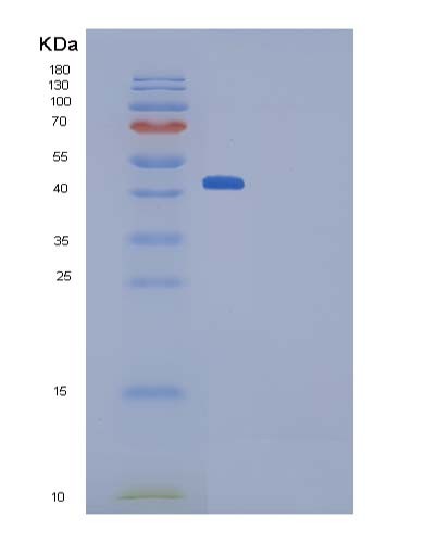 SDS-PAGE analysis of Mouse Ptn (Pleiotrophin) - Recombinant Protein, CATMouse Ptn (Pleiotrophin) - Recombinant Protein