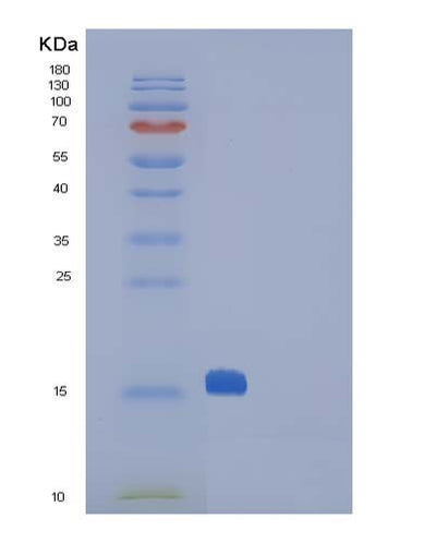 SDS-PAGE analysis of Mouse Ctla4 (Cytotoxic T-Lymphocyte Protein 4) - Recombinant Protein, CAT# BLT-05091P, showing >85% purity under 15% SDS-PAGE (Reduced)Mouse Ctla4 (Cytotoxic T-Lymphocyte Protein 4) - Recombinant Protein