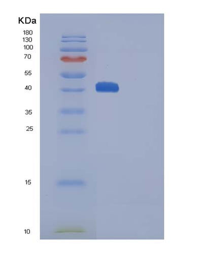 SDS-PAGE analysis of Human CTLA4 (Cytotoxic T-Lymphocyte Protein 4) - Recombinant Protein, CAT# BLT-05093P, showing >90% purity under 15% SDS-PAGE (Reduced)Human CTLA4 (Cytotoxic T-Lymphocyte Protein 4) - Recombinant Protein