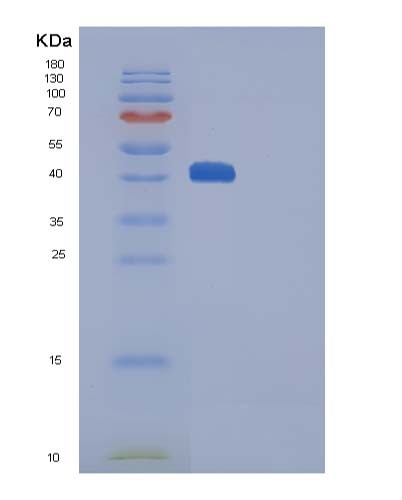 SDS-PAGE analysis of Human CTLA4 (Cytotoxic T-Lymphocyte Protein 4) - Recombinant Protein, CATHuman CTLA4 (Cytotoxic T-Lymphocyte Protein 4) - Recombinant Protein