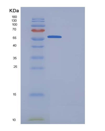 SDS-PAGE analysis of Human GRN (Progranulin) - Recombinant Protein, CAT# BLT-05099P, showing >85% purity under 15% SDS-PAGE (Reduced)Human GRN (Progranulin) - Recombinant Protein