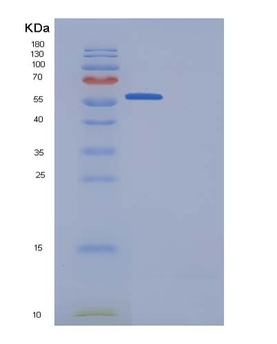 SDS-PAGE analysis of Human GRN (Progranulin) - Recombinant Protein, CATHuman GRN (Progranulin) - Recombinant Protein