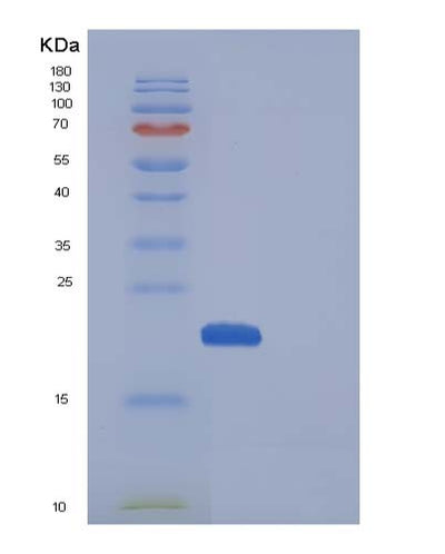 SDS-PAGE analysis of Mouse Manf (Mesencephalic Astrocyte-Derived Neurotrophic Factor) - Recombinant Protein, CAT# BLT-05102P, showing >85% purity under 15% SDS-PAGE (Reduced)Mouse Manf (Mesencephalic Astrocyte-Derived Neurotrophic Factor) - Recombinant Protein