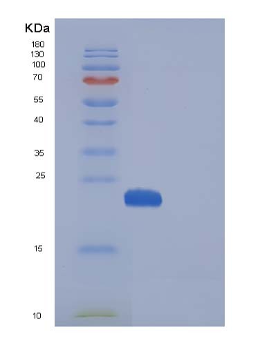 SDS-PAGE analysis of Human MANF (Mesencephalic Astrocyte-Derived Neurotrophic Factor) - Recombinant Protein, CATHuman MANF (Mesencephalic Astrocyte-Derived Neurotrophic Factor) - Recombinant Protein