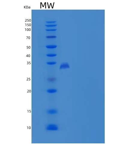 SDS-PAGE analysis of Human CNPY4 (Protein Canopy Homolog 4) - Recombinant Protein, CAT# BLT-05131P, showing >85% purity under 15% SDS-PAGE (Reduced)Human CNPY4 (Protein Canopy Homolog 4) - Recombinant Protein