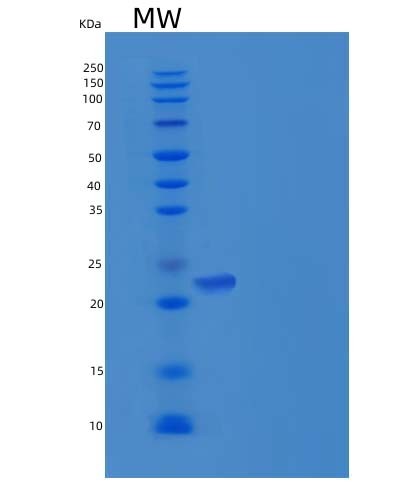 SDS-PAGE analysis of Human FCGR2A (Low Affinity Immunoglobulin Gamma Fc Region Receptor Ii-A) - Recombinant Protein, CAT# BLT-05832P, showing >90% purity under 15% SDS-PAGE (Reduced)Human FCGR2A (Low Affinity Immunoglobulin Gamma Fc Region Receptor Ii-A) - Recombinant Protein