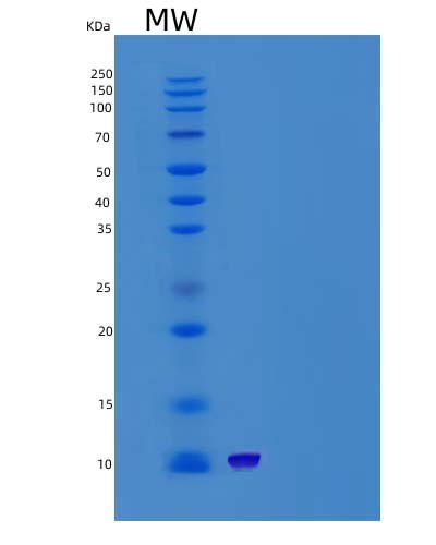 SDS-PAGE analysis of Human CARTPT (Cocaine- And Amphetamine-Regulated Transcript Protein) - Recombinant Protein, CAT# BLT-05163P, showing >85% purity under 15% SDS-PAGE (Reduced)Human CARTPT (Cocaine- And Amphetamine-Regulated Transcript Protein) - Recombinant Protein