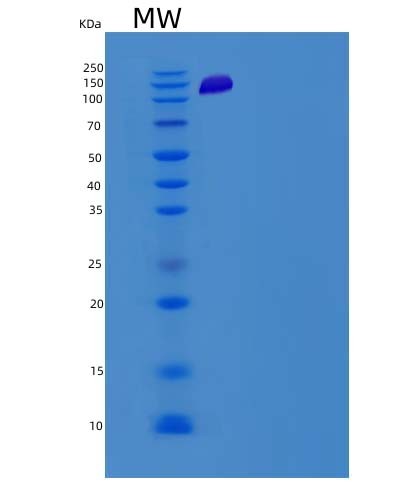 SDS-PAGE analysis of Mouse Prkcd (Protein Kinase C Delta Type) - Recombinant Protein, CAT# BLT-05176P, showing >90% purity under 15% SDS-PAGE (Reduced)Mouse Prkcd (Protein Kinase C Delta Type) - Recombinant Protein