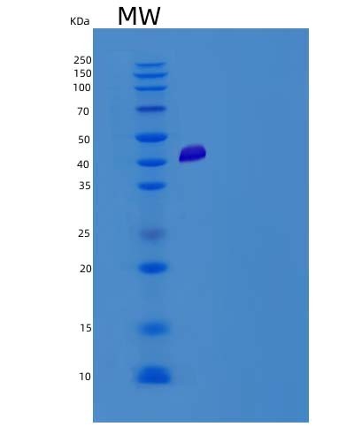 SDS-PAGE analysis of Human ADCYAP1R1 (Pituitary Adenylate Cyclase-Activating Polypeptide Type I Receptor) - Recombinant Protein, CAT# BLT-05177P, showing >85% purity under 15% SDS-PAGE (Reduced)Human ADCYAP1R1 (Pituitary Adenylate Cyclase-Activating Polypeptide Type I Receptor) - Recombinant Protein