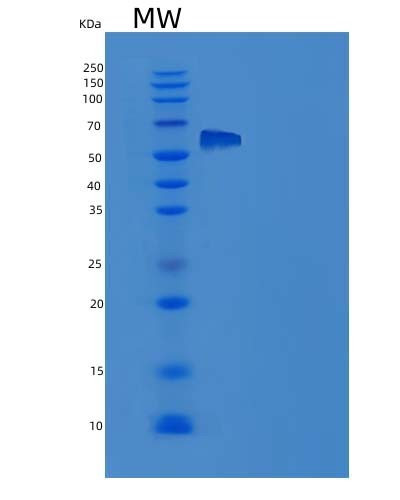 SDS-PAGE analysis of Human IL1RAPL1 (Interleukin-1 Receptor Accessory Protein-Like 1) - Recombinant Protein, CAT# BLT-05198P, showing >95% purity under 15% SDS-PAGE (Reduced)Human IL1RAPL1 (Interleukin-1 Receptor Accessory Protein-Like 1) - Recombinant Protein