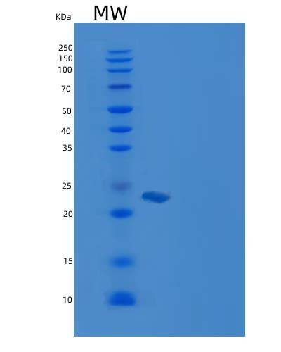 SDS-PAGE analysis of Human RHEB (Gtp-Binding Protein Rheb) - Recombinant Protein, CATHuman RHEB (Gtp-Binding Protein Rheb) - Recombinant Protein